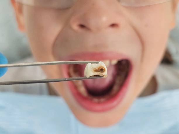 Best Holiday Emergency Dentist in Encantada Ranchito El Calaboz, TX